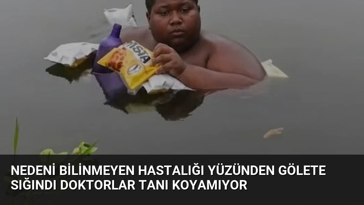 Nedeni Bilinmeyen Hastalığı Yüzünden Gölete Sığındı Doktorlar Tanı Koyamıyor